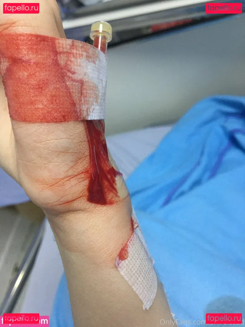 shiroissad Onlyfans Photo Gallery 