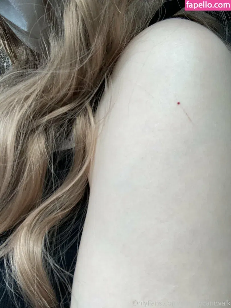 chrissycantwalk Onlyfans Photo Gallery 