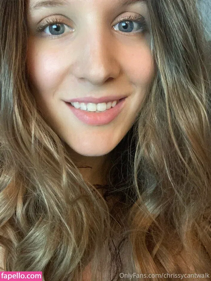 chrissycantwalk Onlyfans Photo Gallery 