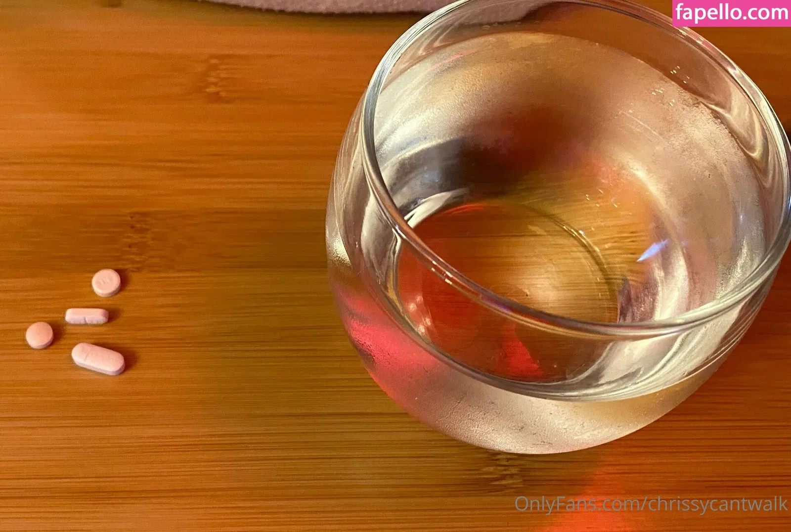 chrissycantwalk Onlyfans Photo Gallery 