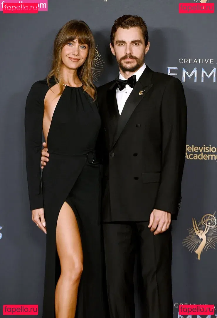 Alison Brie Onlyfans Photo Gallery 