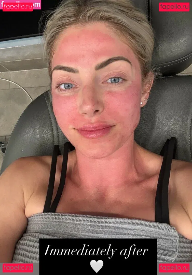 Alexa Bliss Onlyfans Photo Gallery 