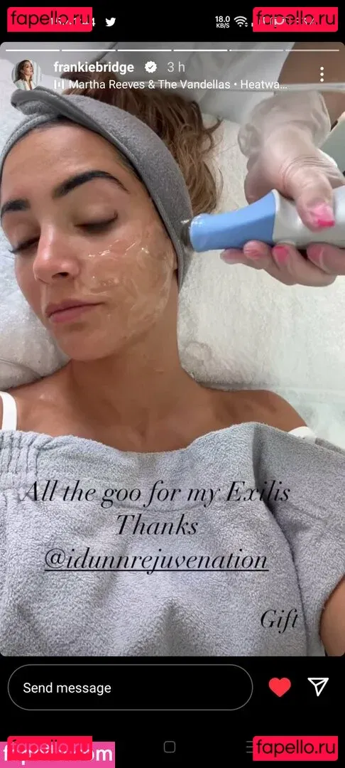 Frankie Bridge Onlyfans Photo Gallery 