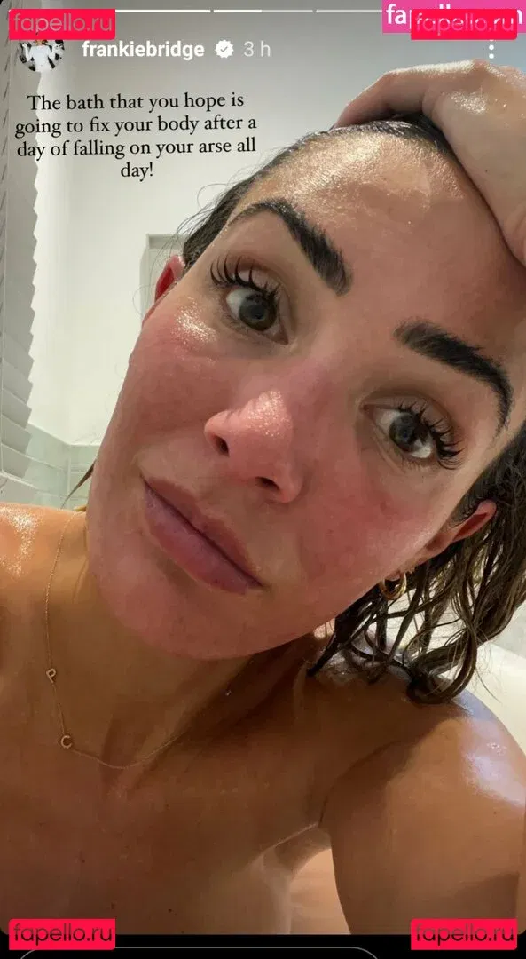 Frankie Bridge Onlyfans Photo Gallery 