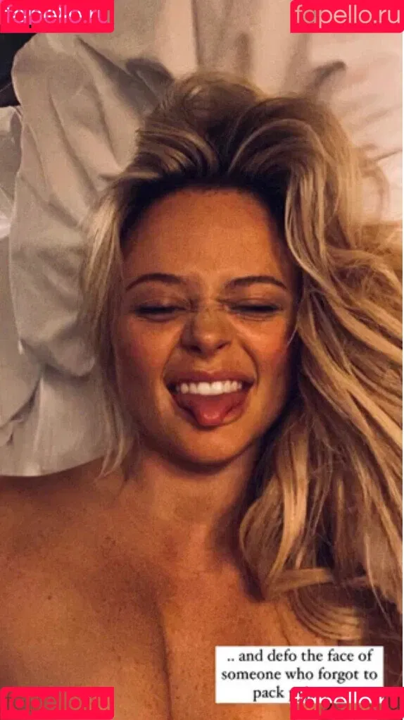 Emily Atack Onlyfans Photo Gallery 