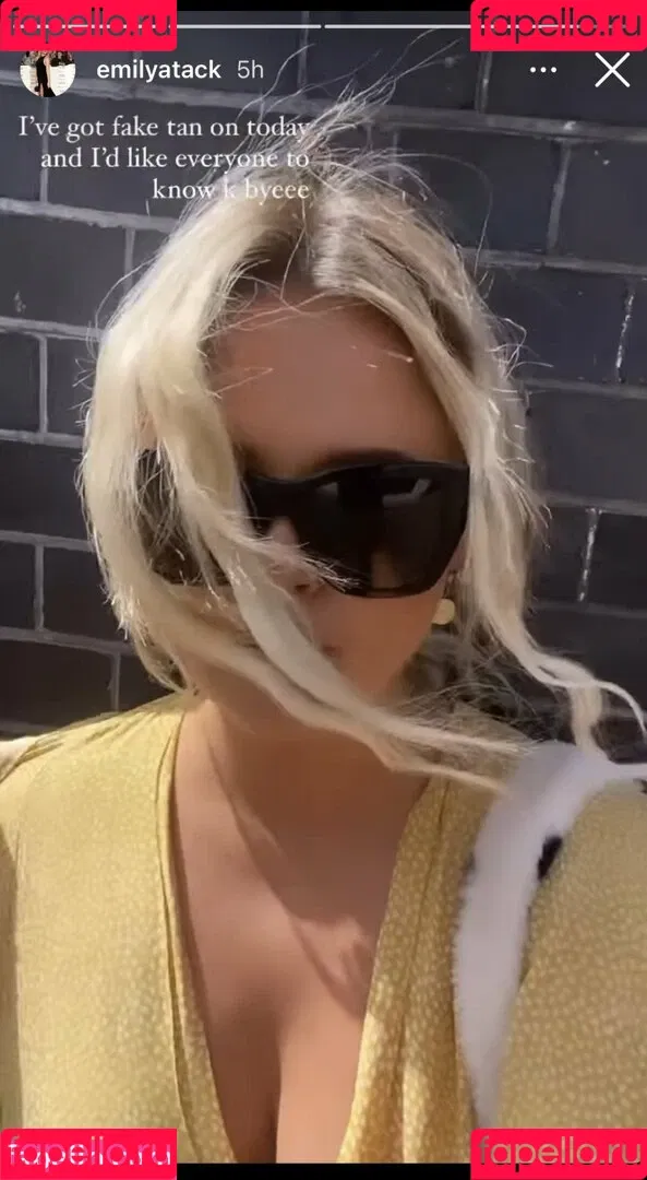 Emily Atack Onlyfans Photo Gallery 