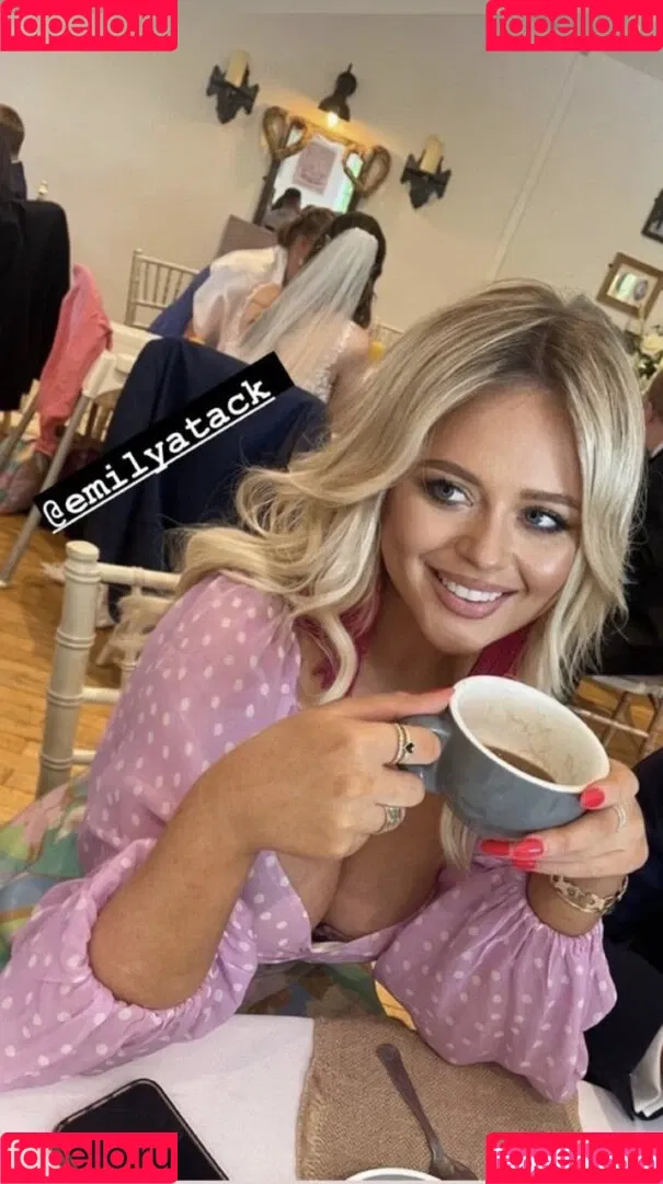 Emily Atack Onlyfans Photo Gallery 