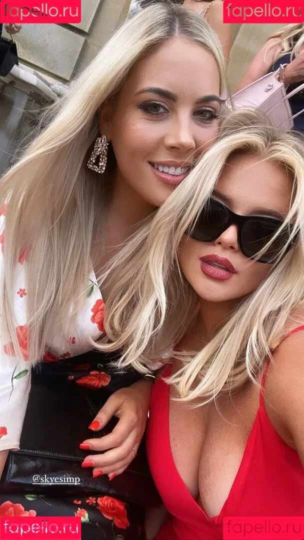 Emily Atack Onlyfans Photo Gallery 