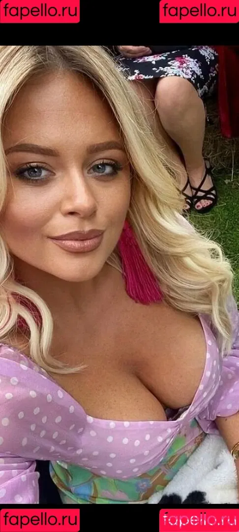 Emily Atack Onlyfans Photo Gallery 