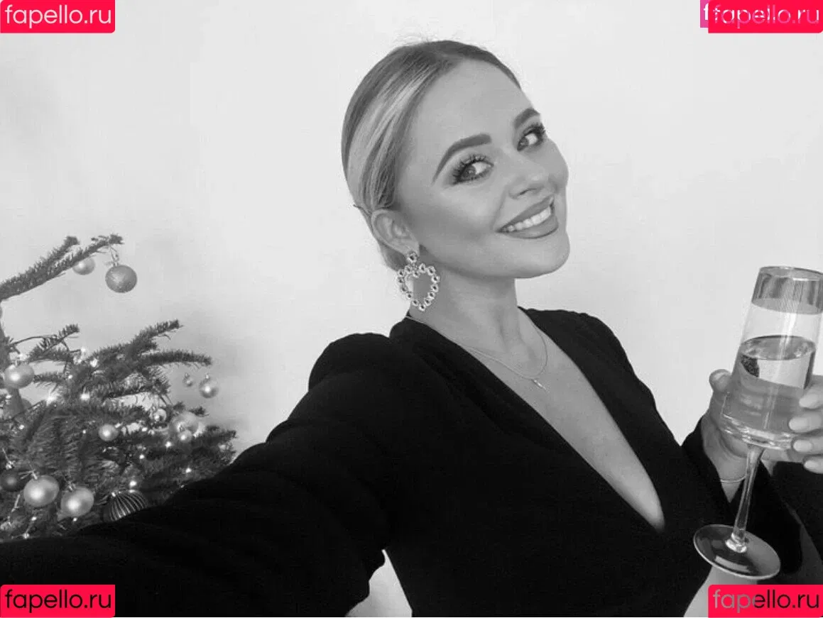 Emily Atack Onlyfans Photo Gallery 