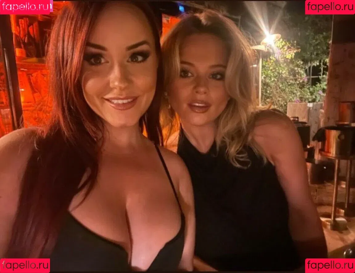 Emily Atack Onlyfans Photo Gallery 