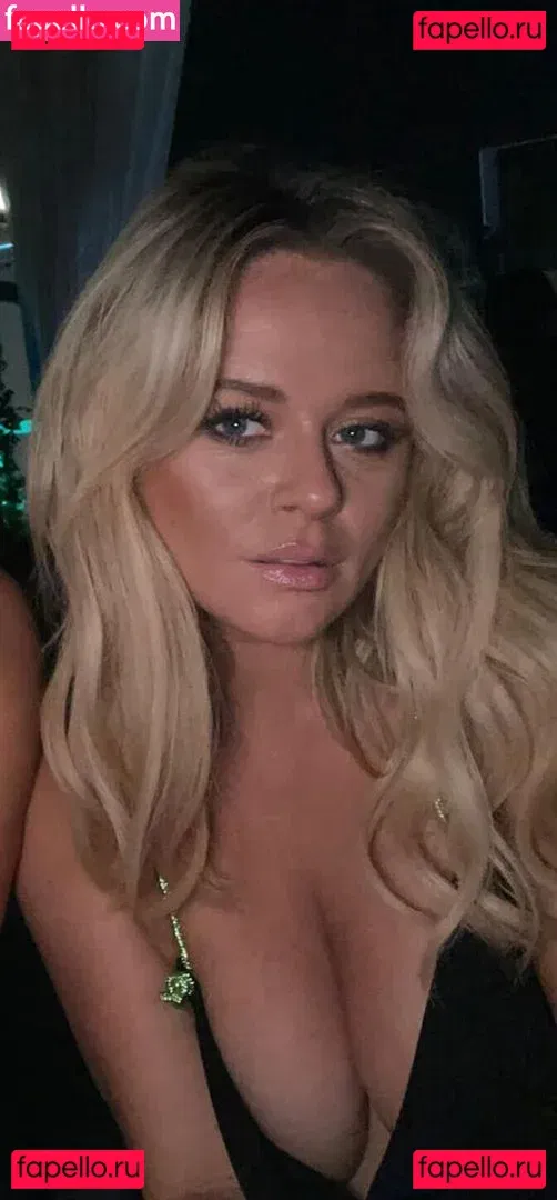 Emily Atack Onlyfans Photo Gallery 