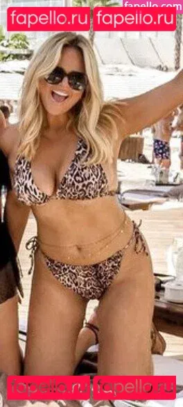 Emily Atack Onlyfans Photo Gallery 