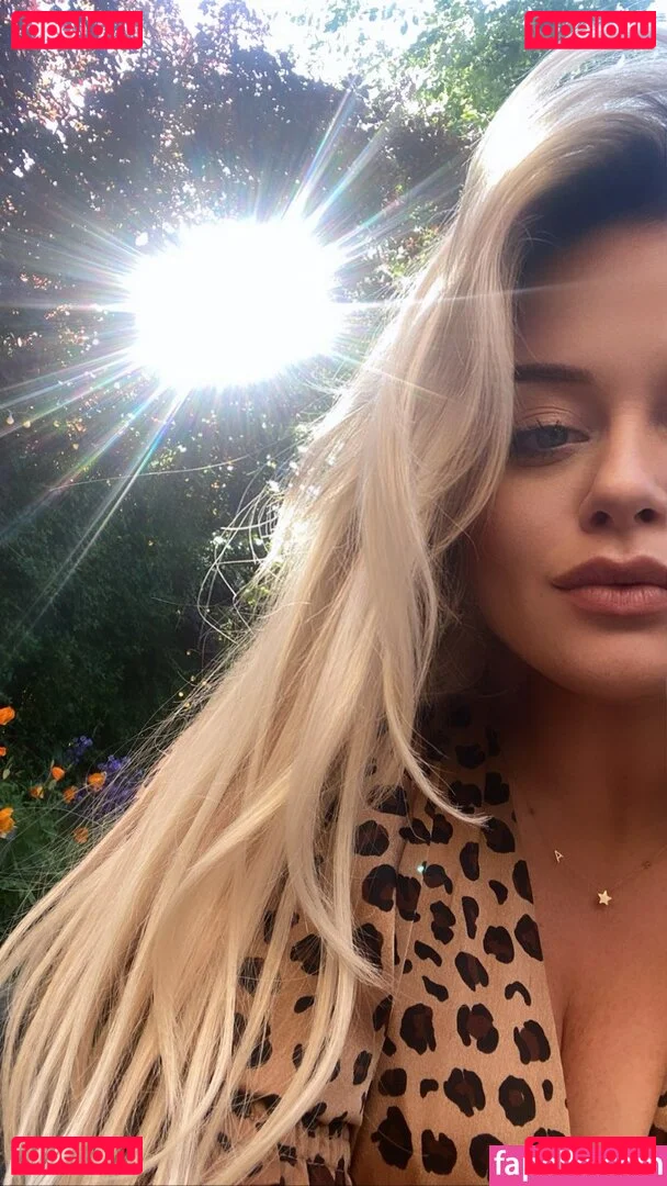 Emily Atack Onlyfans Photo Gallery 