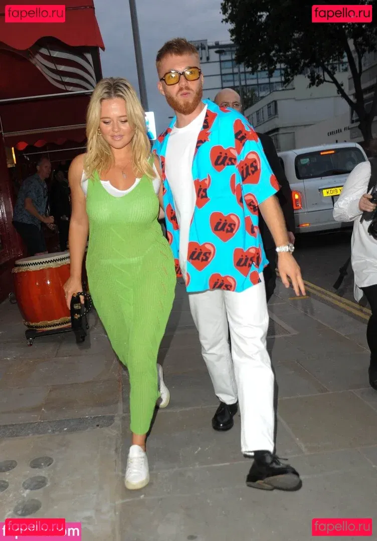 Emily Atack Onlyfans Photo Gallery 