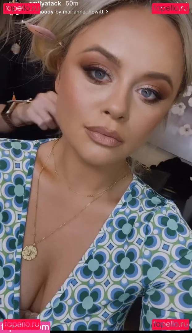 Emily Atack Onlyfans Photo Gallery 