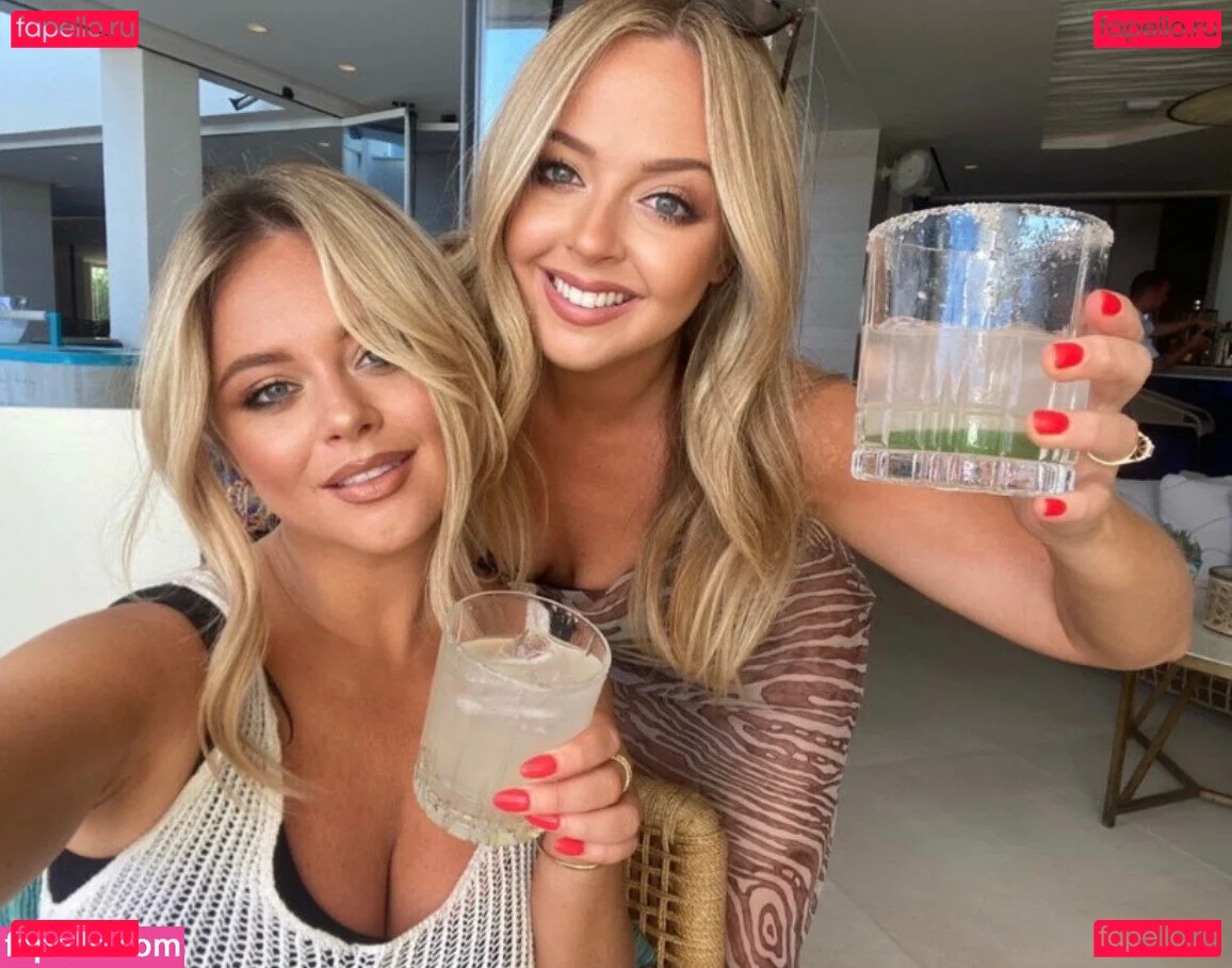 Emily Atack Onlyfans Photo Gallery 