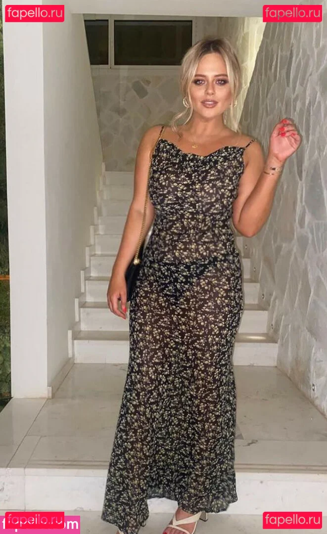 Emily Atack Onlyfans Photo Gallery 