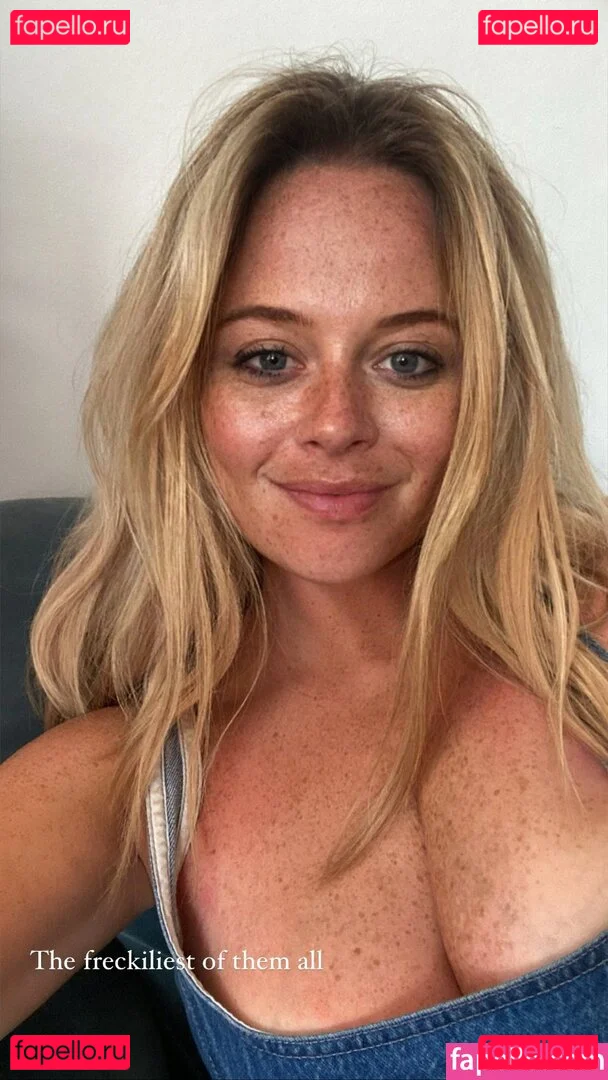 Emily Atack Onlyfans Photo Gallery 