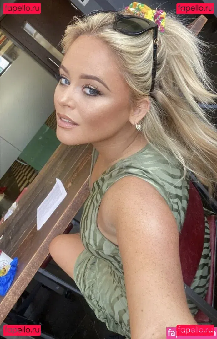 Emily Atack Onlyfans Photo Gallery 
