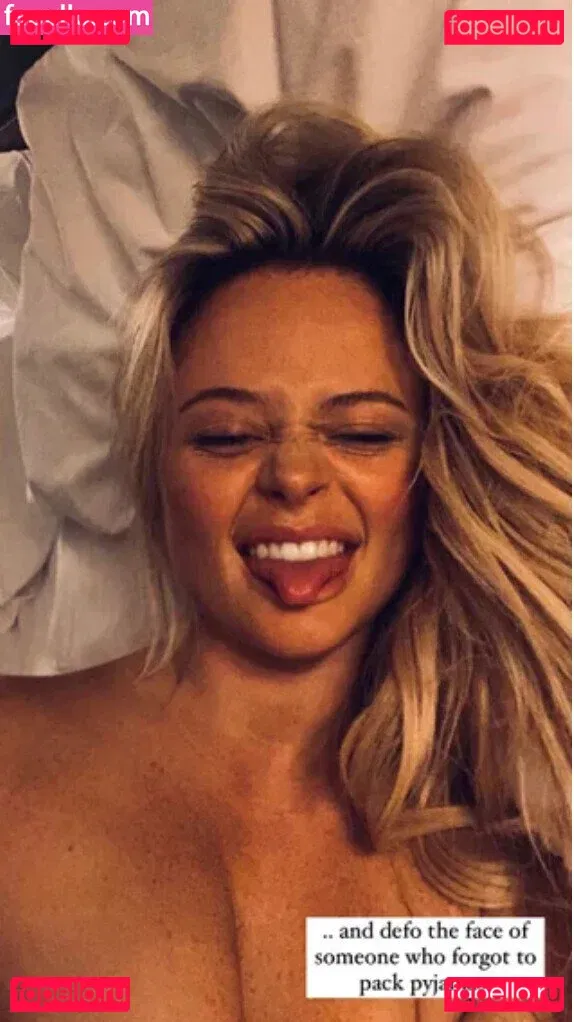 Emily Atack Onlyfans Photo Gallery 