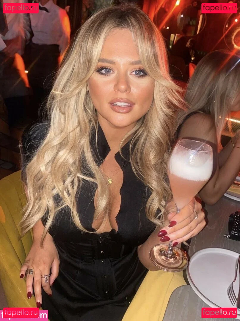 Emily Atack Onlyfans Photo Gallery 