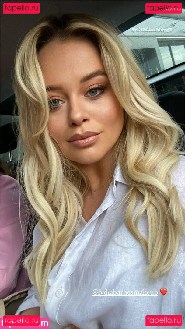 Emily Atack Onlyfans Photo Gallery 