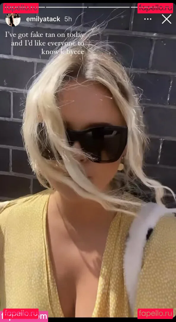 Emily Atack Onlyfans Photo Gallery 