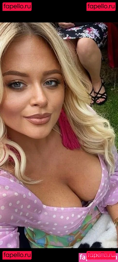 Emily Atack Onlyfans Photo Gallery 