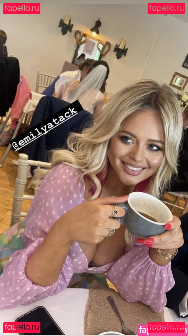 Emily Atack Onlyfans Photo Gallery 
