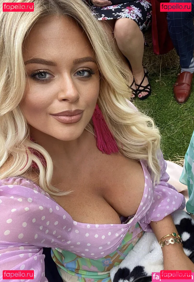 Emily Atack Onlyfans Photo Gallery 