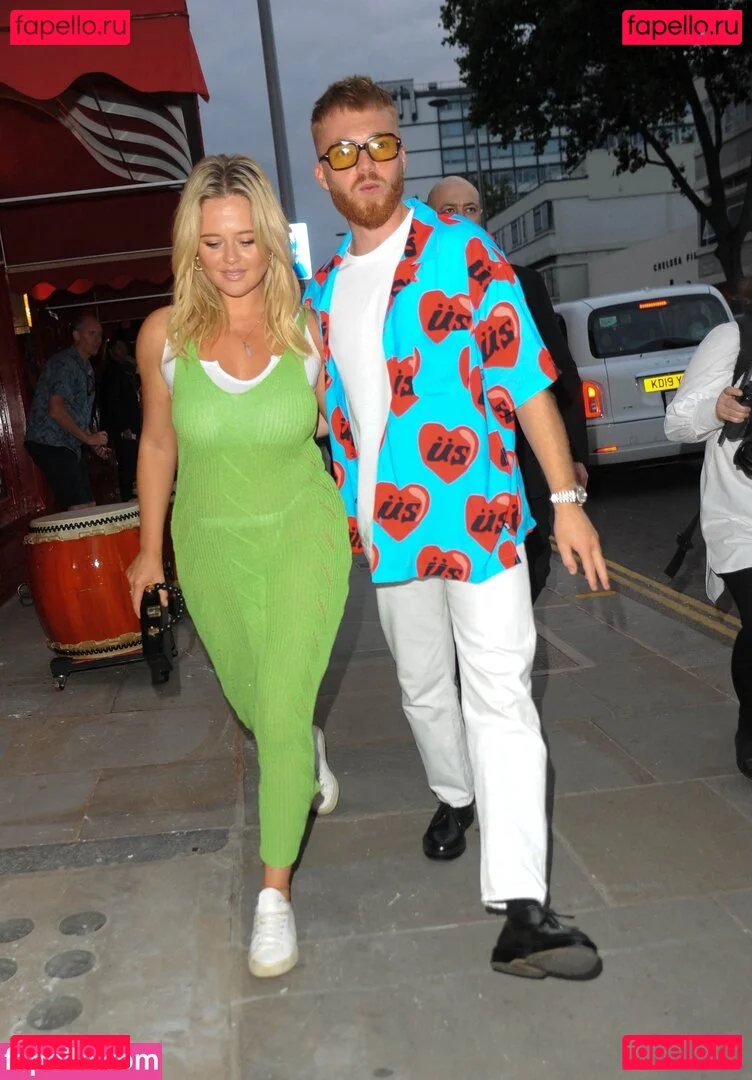 Emily Atack Onlyfans Photo Gallery 