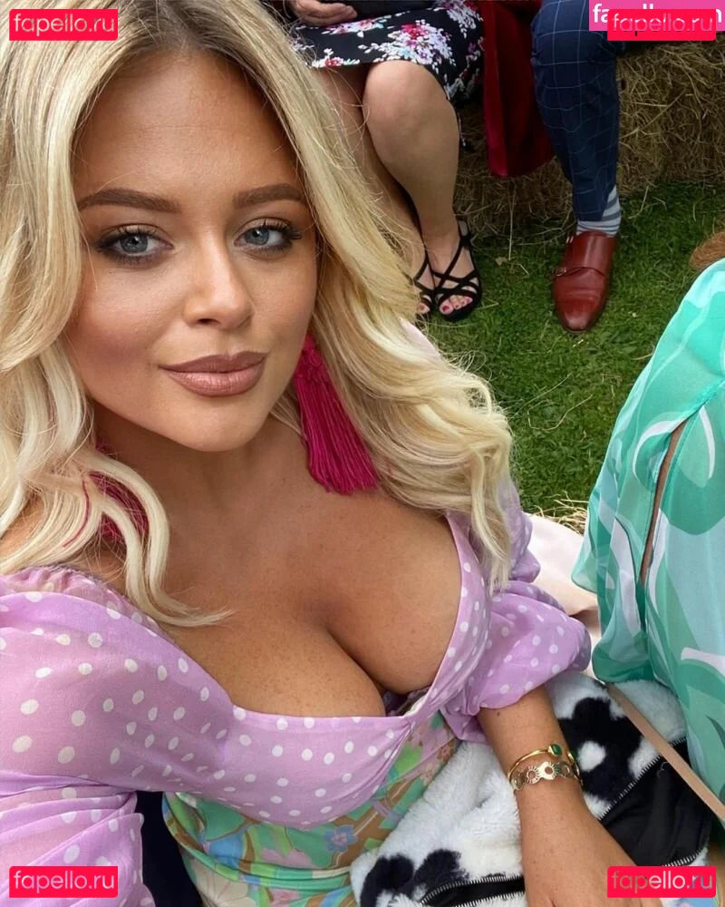 Emily Atack Onlyfans Photo Gallery 