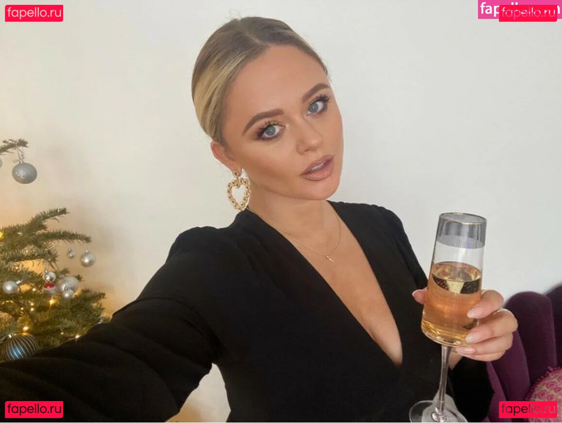 Emily Atack Onlyfans Photo Gallery 