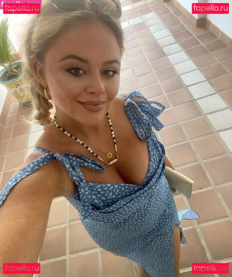 Emily Atack Onlyfans Photo Gallery 