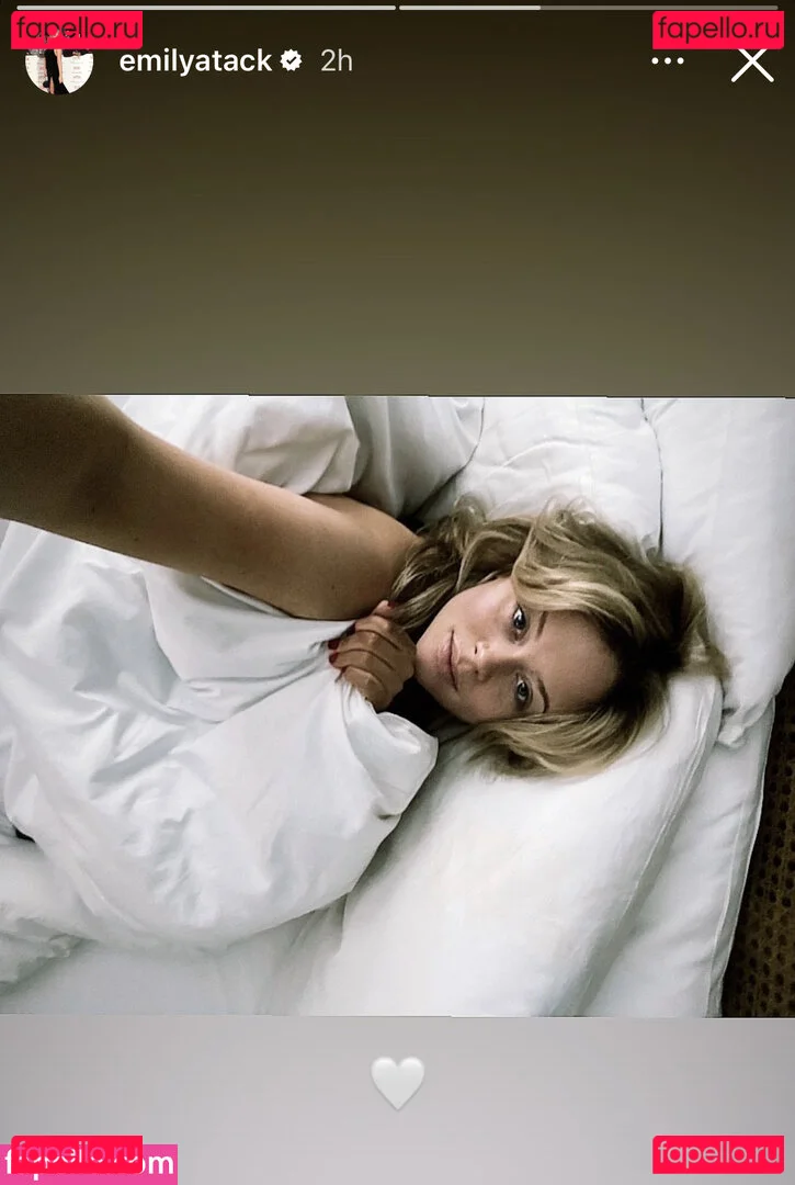 Emily Atack Onlyfans Photo Gallery 