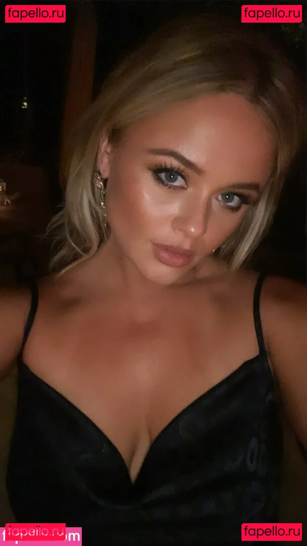 Emily Atack Onlyfans Photo Gallery 
