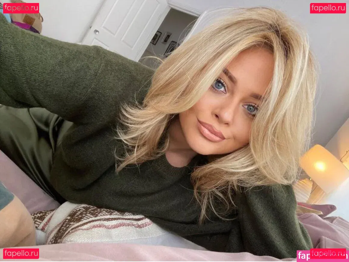 Emily Atack Onlyfans Photo Gallery 