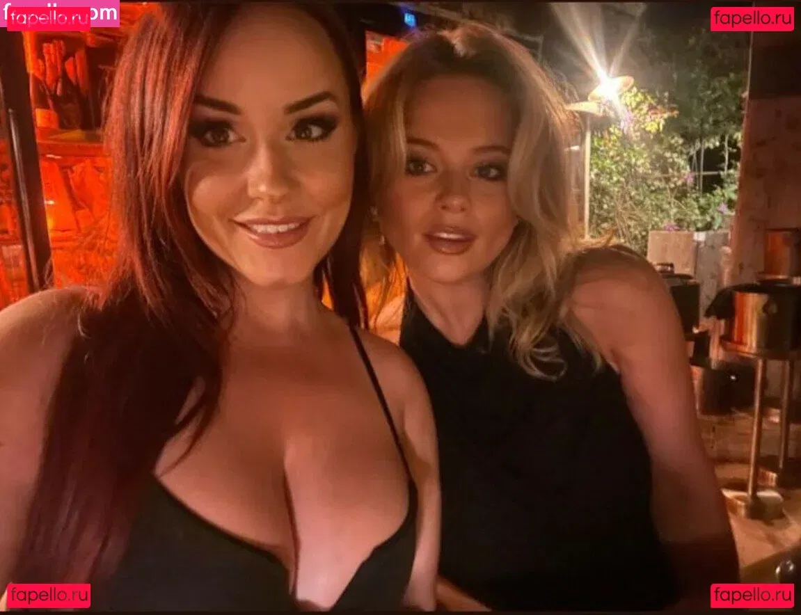 Emily Atack Onlyfans Photo Gallery 