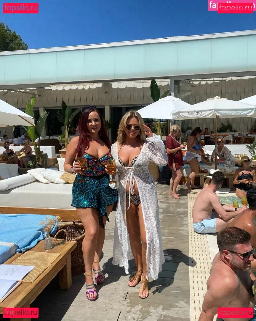 Emily Atack Onlyfans Photo Gallery 