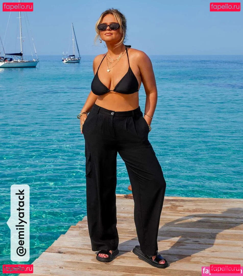 Emily Atack Onlyfans Photo Gallery 