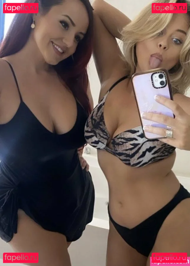 Emily Atack Onlyfans Photo Gallery 