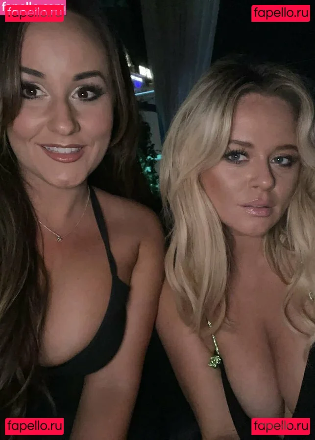 Emily Atack Onlyfans Photo Gallery 