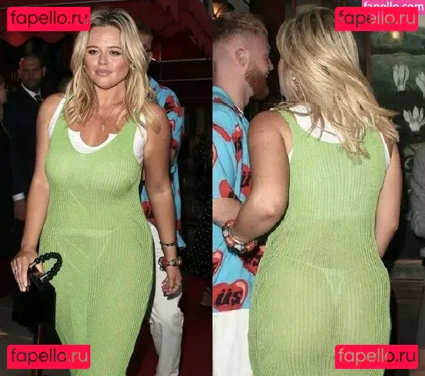 Emily Atack Onlyfans Photo Gallery 