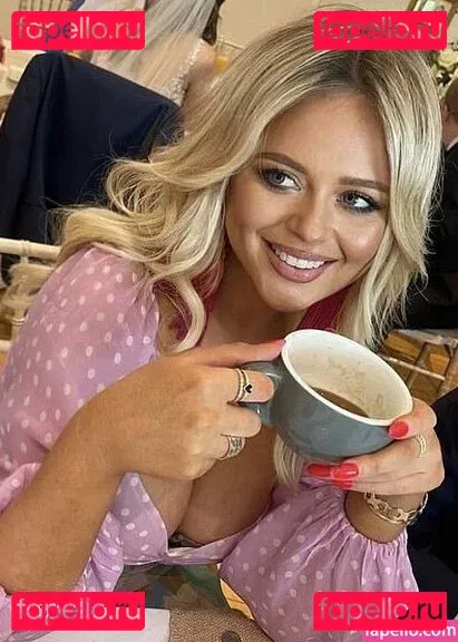 Emily Atack Onlyfans Photo Gallery 