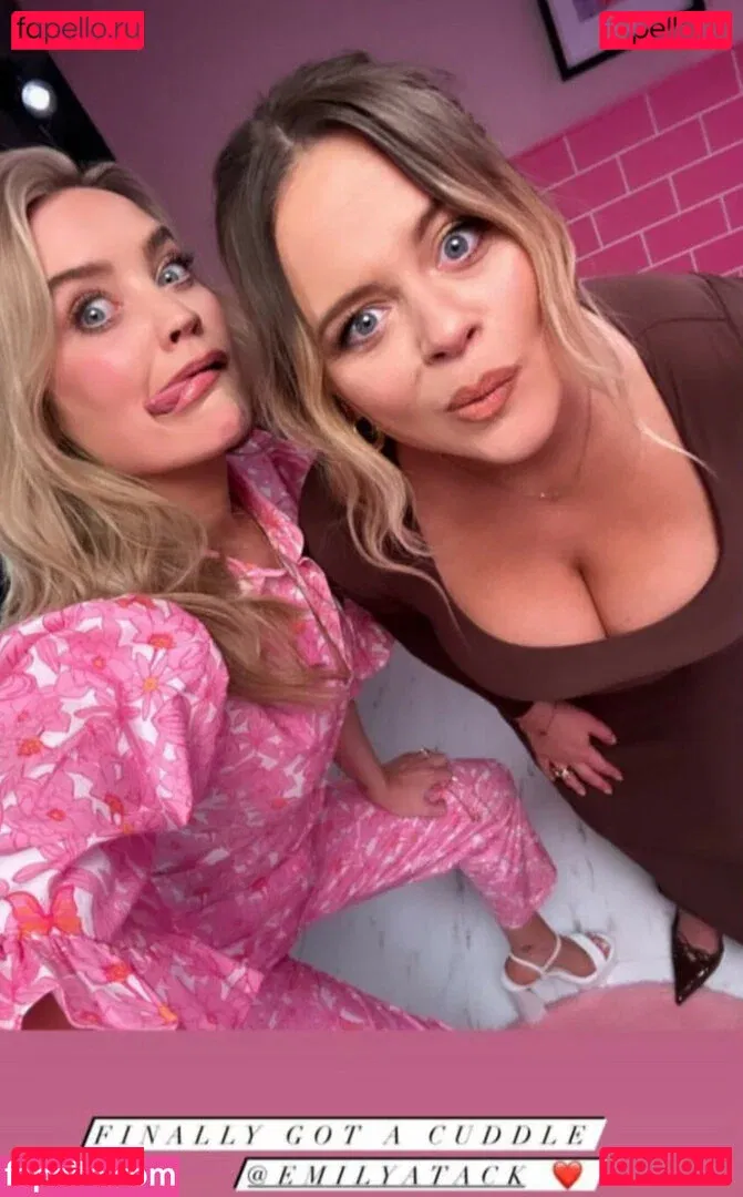 Emily Atack Onlyfans Photo Gallery 