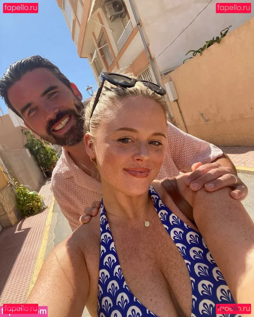 Emily Atack Onlyfans Photo Gallery 