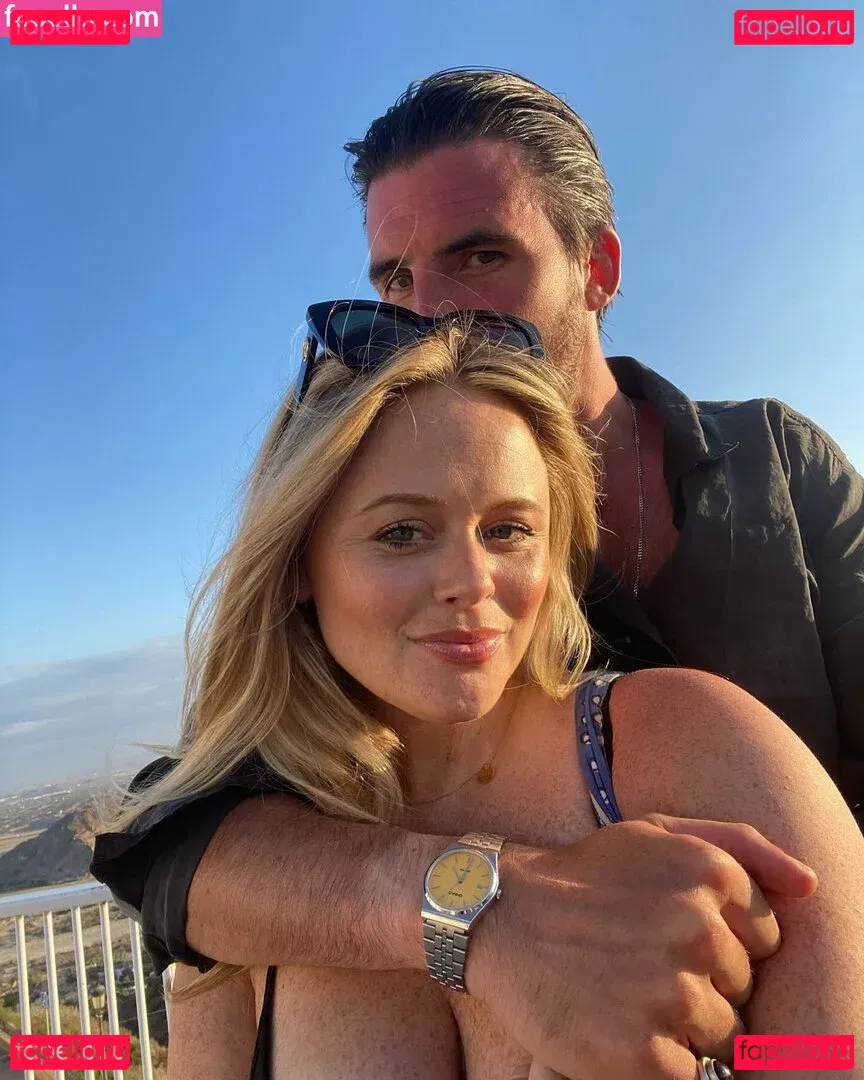 Emily Atack Onlyfans Photo Gallery 