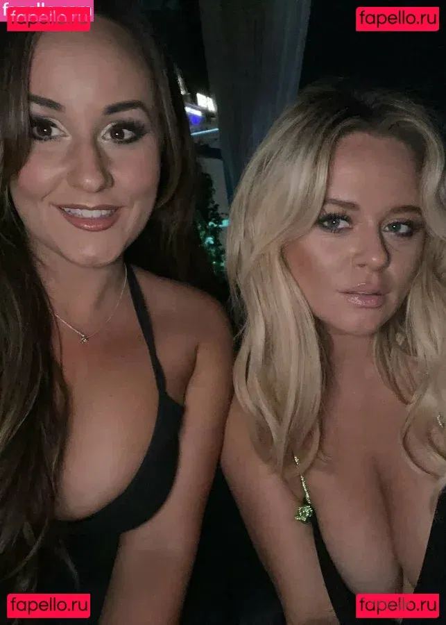 Emily Atack Onlyfans Photo Gallery 