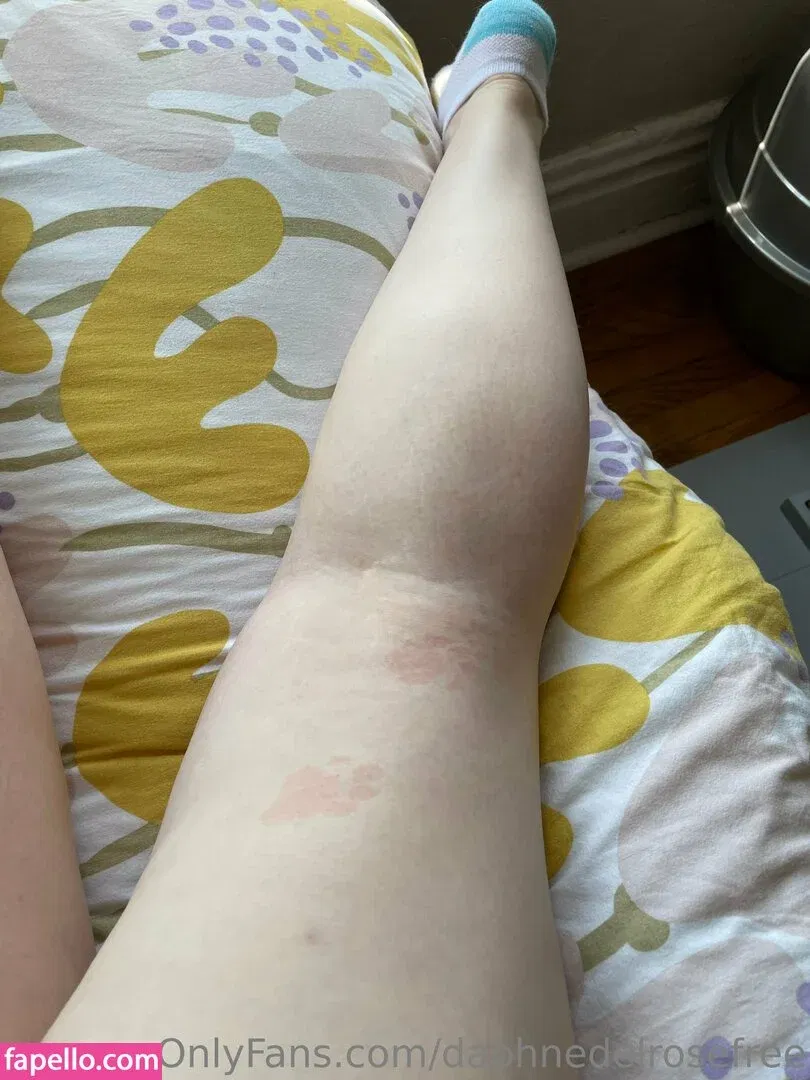 daphnedelrose Onlyfans Photo Gallery 